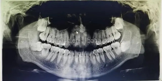 Dental CT 3D CBCT Digitale Röntgengeräte China